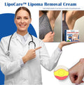 Doctor's No 1 choice | Lipoma Removal Cream (Pack of 1)